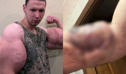 «Прости меня, Боженька»: фрик-блогер Руки-Базуки рассказал про сложную операцию (ФОТО)