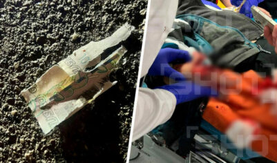 «Идет СВО, возможны провокации». Школьнику в Красногорске разорвало руку при попытке поднять деньги