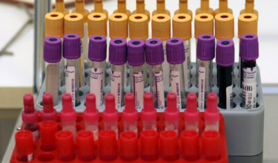 В крови «богородского маньяка» обнаружены наркотические вещества