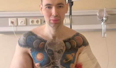 СМИ: блогеру Руки-Базуки грозит скорая ампутация конечностей (ФОТО)