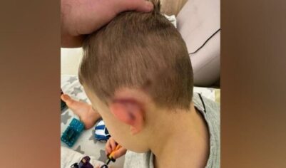 «Спас Вилли»: отец искусанного ротвейлерами мальчика рассказал о случившемся